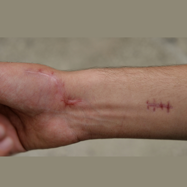 Maria Ciaccio Scarwork4